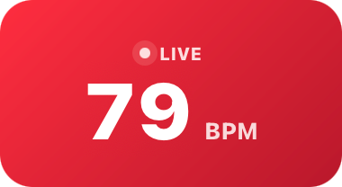红色悬浮窗显示 79 BPM。